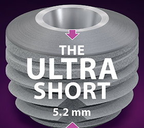 The copaSKY Ultrashort implant