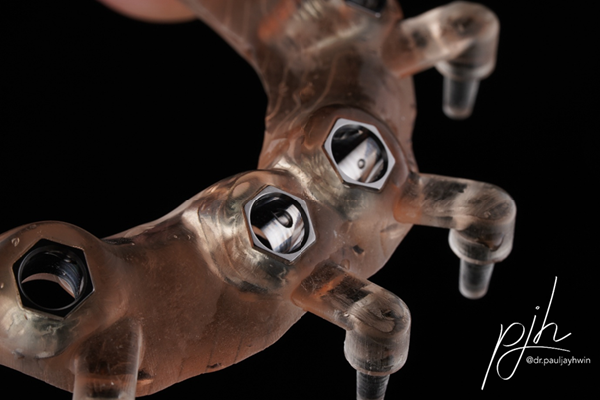 Stackable Guides/Planning