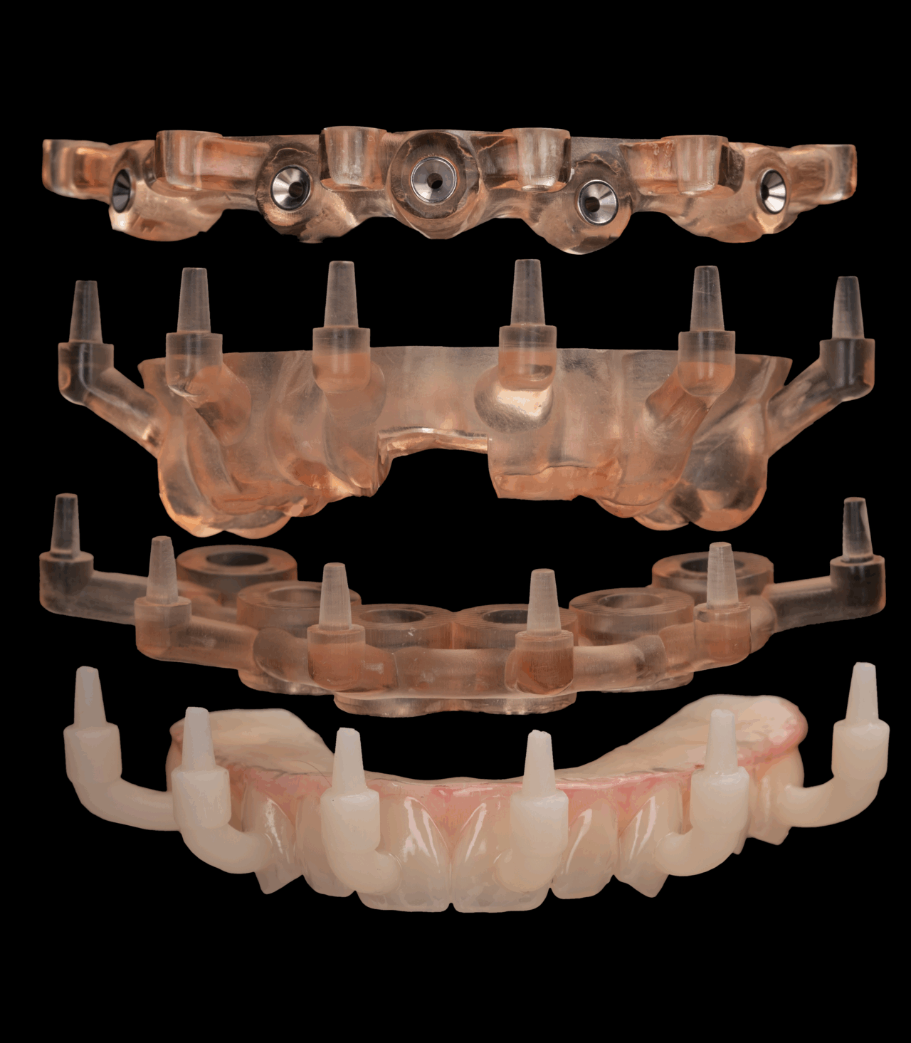 Rowe Stackable Guide Stackable Guides/Planning | DentaFusion Implant Group