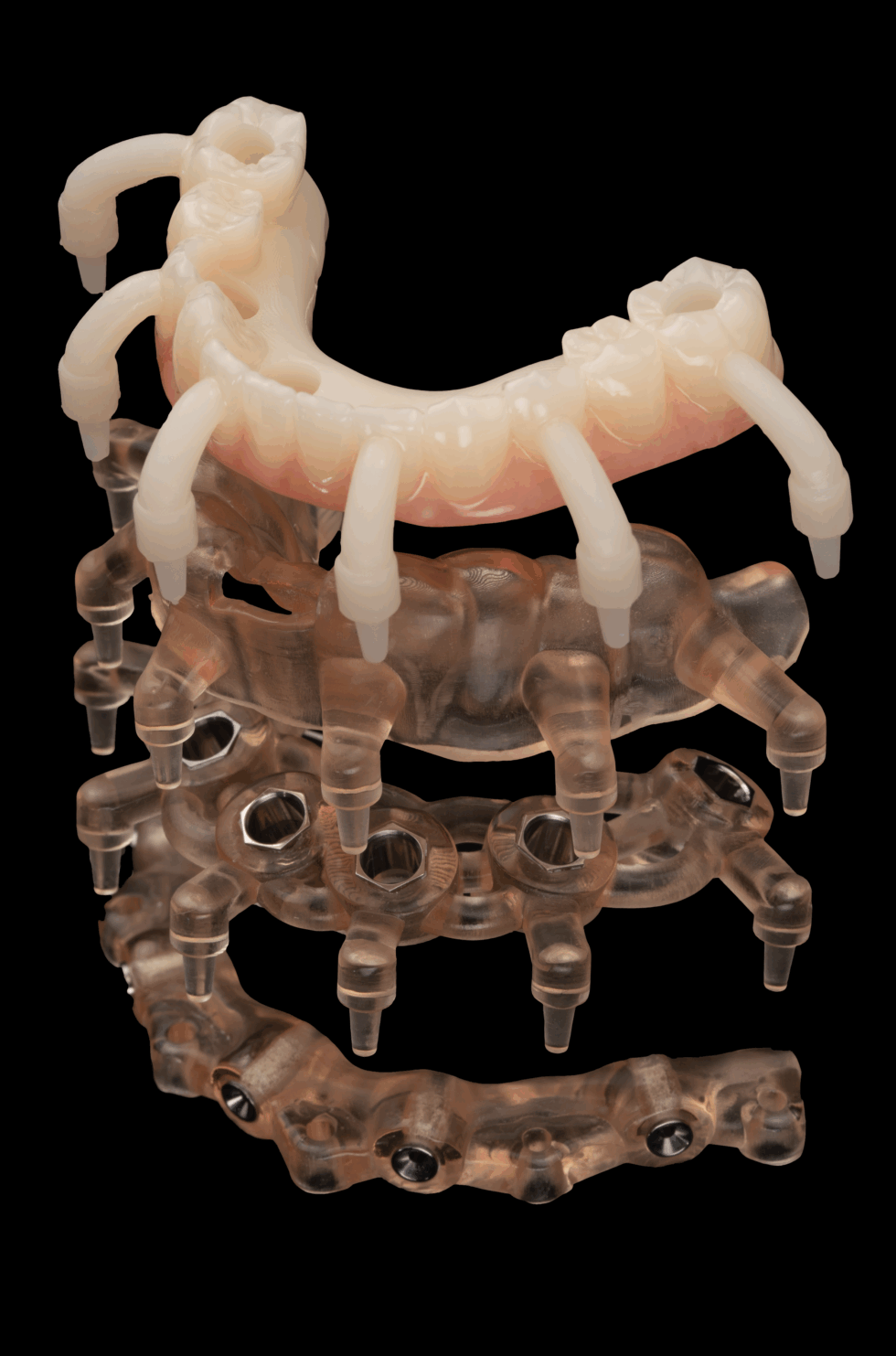 Upper Stackable Guide Stackable Guides/Planning | DentaFusion Implant Group
